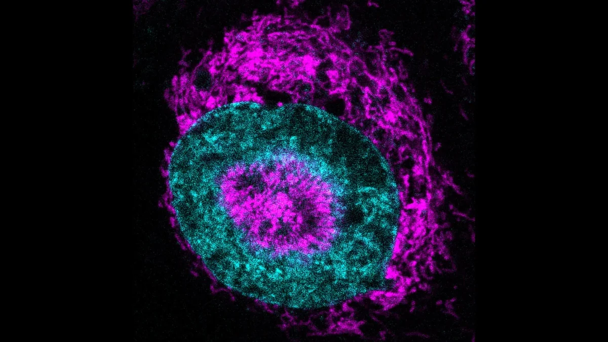 Cientistas descobrem fonte oculta de energia das células cancerígenas