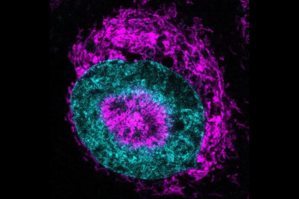 Cientistas descobrem fonte oculta de energia das células cancerígenas