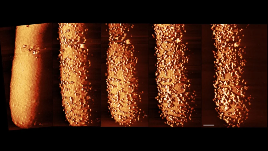 Imagens impressionantes revelam como os antibióticos destroem as defesas bacterianas