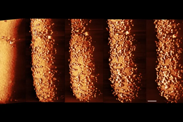 Imagens impressionantes revelam como os antibióticos destroem as defesas bacterianas