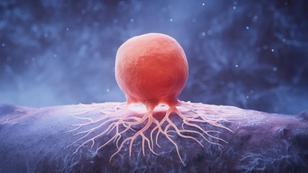 Como cortar lipídios pode eliminar o câncer de mama