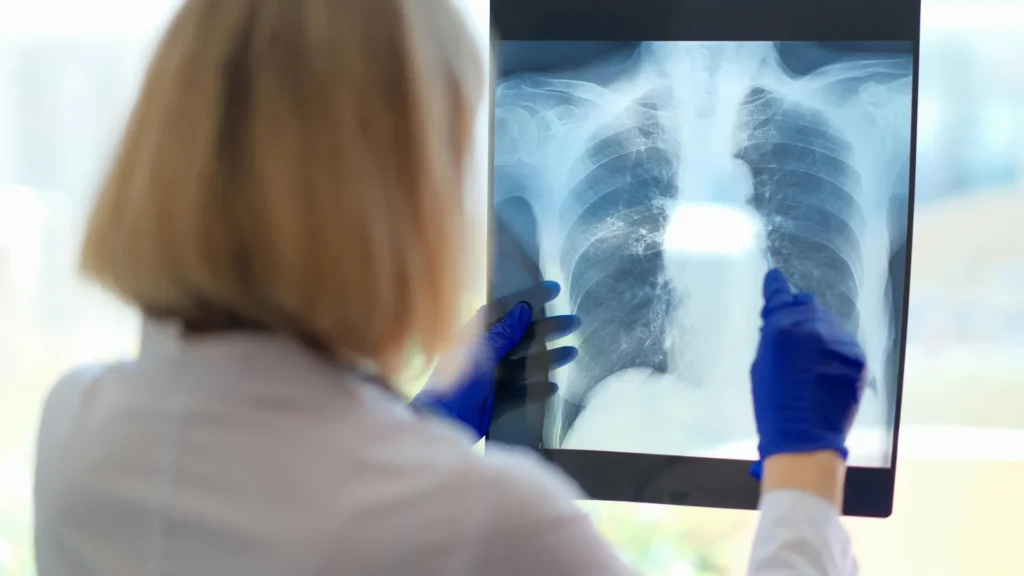 Um problema respiratório oculto pode ser a causa da exaustão devastadora da fadiga crônica