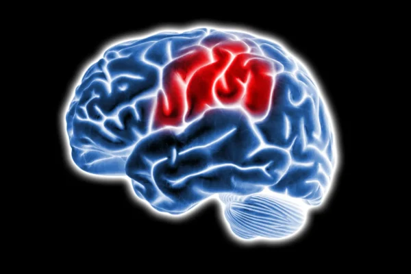 Cientistas descobrem fonte oculta no cérebro que alimenta a demência