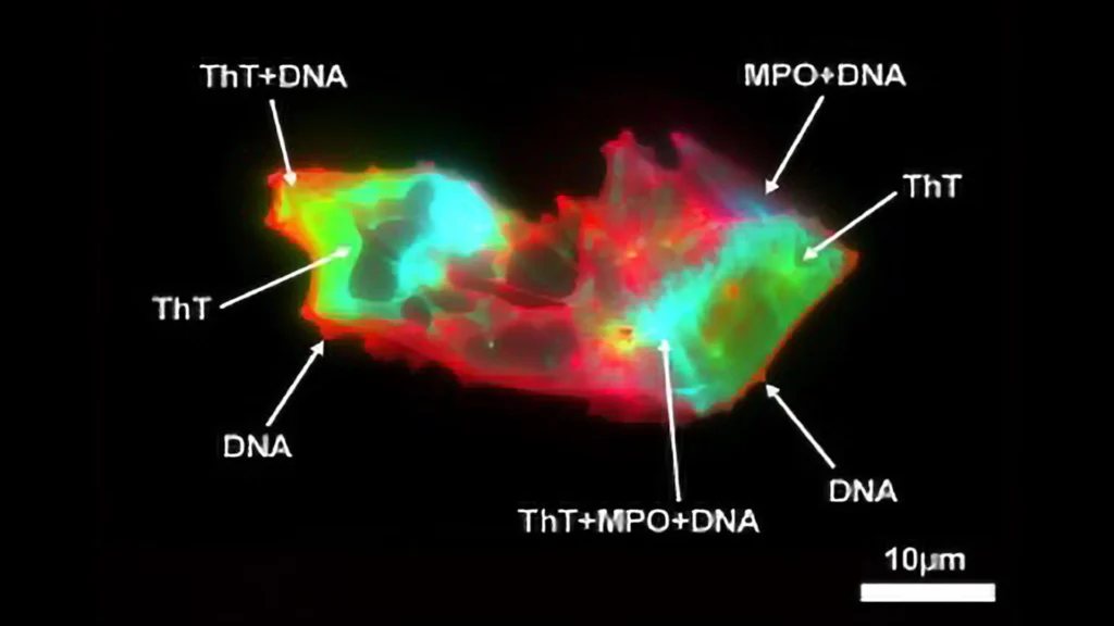 Estranhas Estruturas Microscópicas Encontradas no Sangue de Pacientes com Longo-COVID