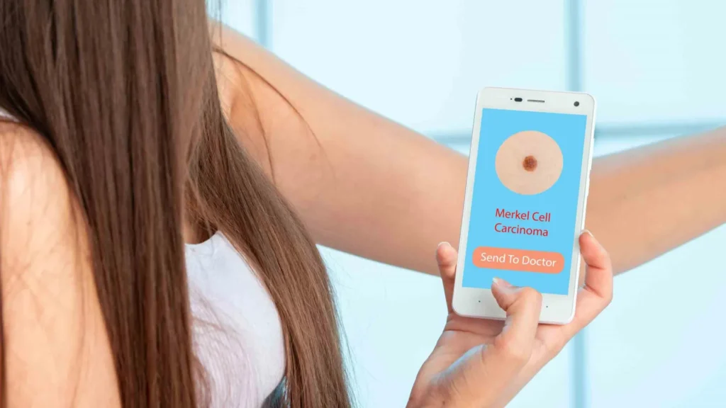 Cientistas descobrem medicamento imunológico que pode deter a propagação mortal do câncer de pele