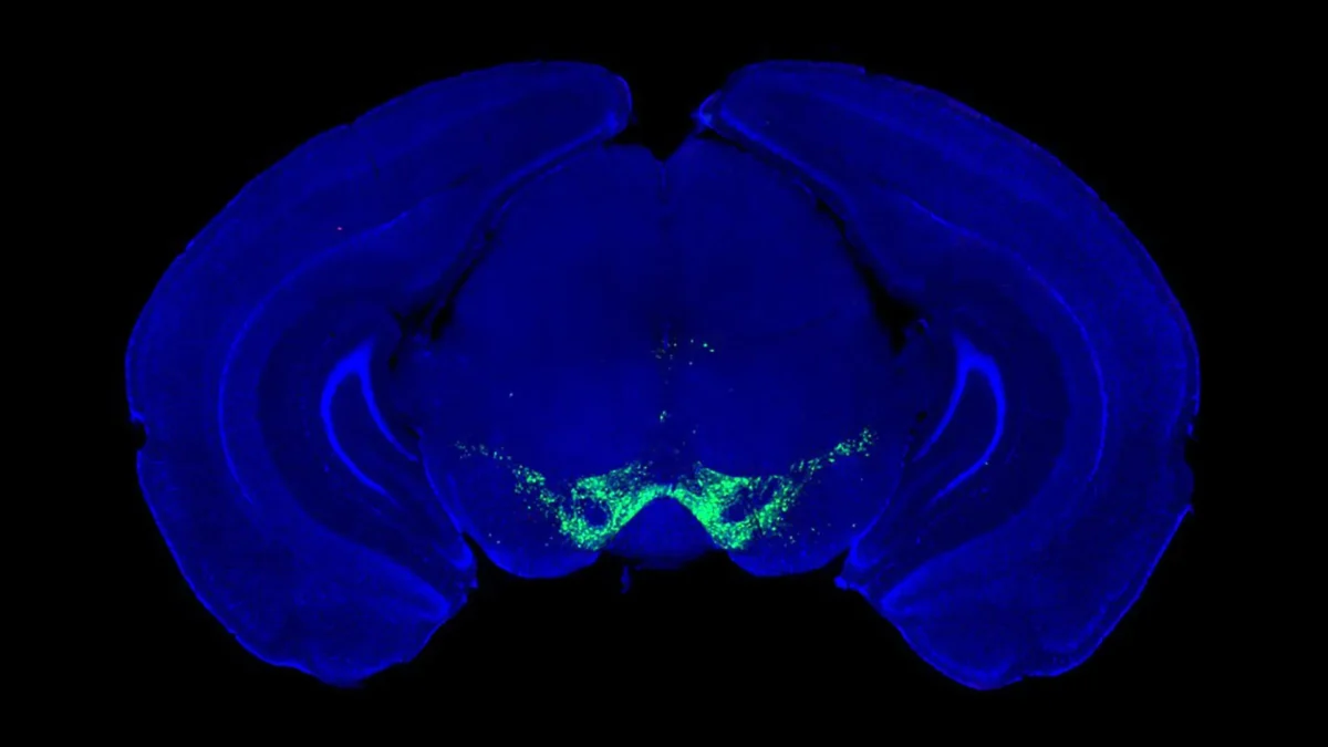 Avanço na Pesquisa sobre Parkinson transforma nossa Compreensão da Dopamina