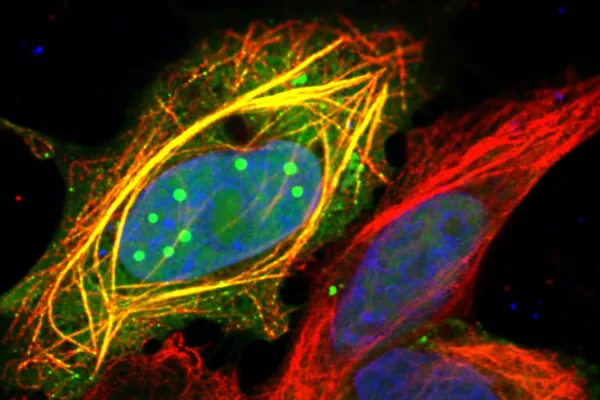 Uma proteína mutante explica o poder mortal da raiva
