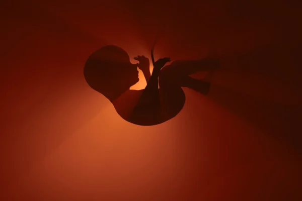 Um "medicamento essencial" popular pode estar colocando bebês não nascidos em risco