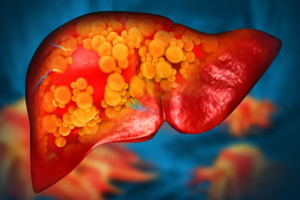 Adoçantes sem açúcar podem ainda prejudicar seu fígado