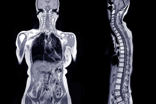Ele comeu um hambúrguer e morreu horas depois. Médicos descobriram uma causa chocante.