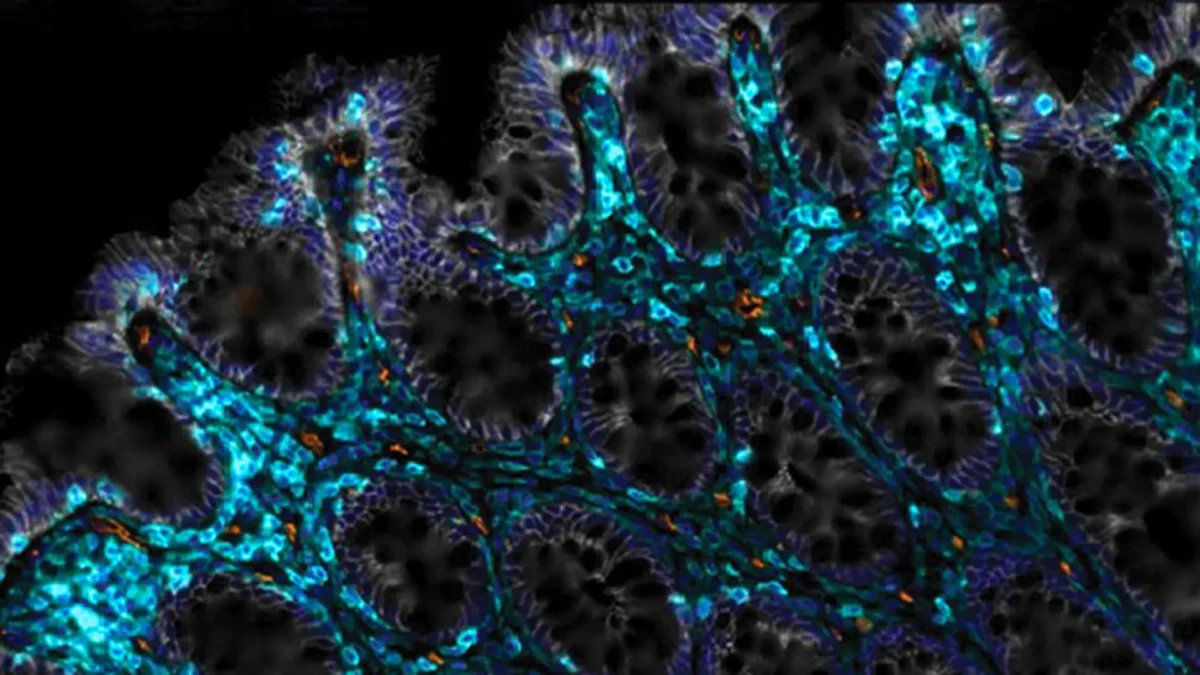 Cientistas descobrem uma forma de ajudar os intestinos envelhecidos a se curarem sozinhos