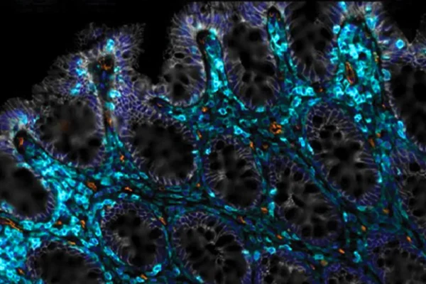 Cientistas descobrem uma forma de ajudar os intestinos envelhecidos a se curarem sozinhos