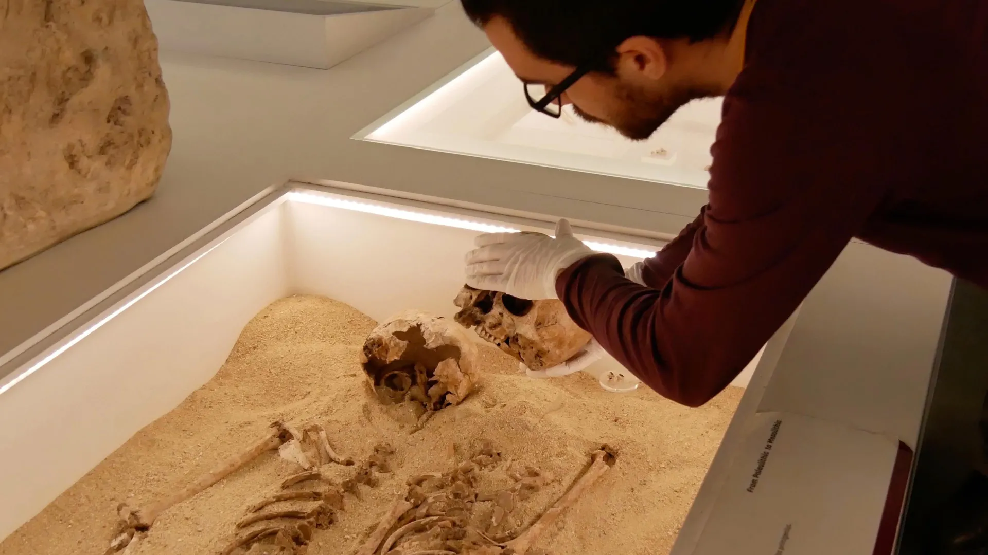 DNA Antigo resolve mistério de 12.000 anos sobre raro distúrbio genético de crescimento