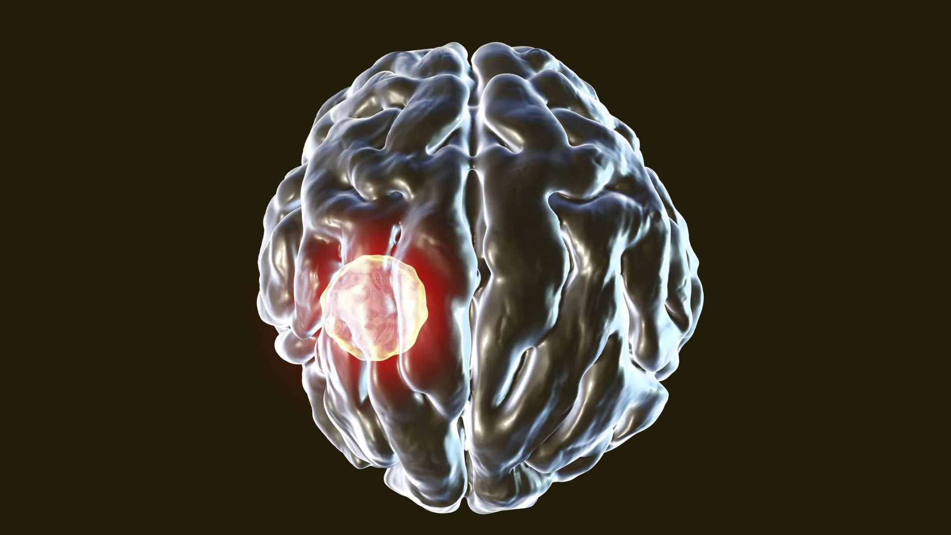 Um em cada três pessoas carrega este parasita cerebral, mas o corpo tem um botão de desligar.