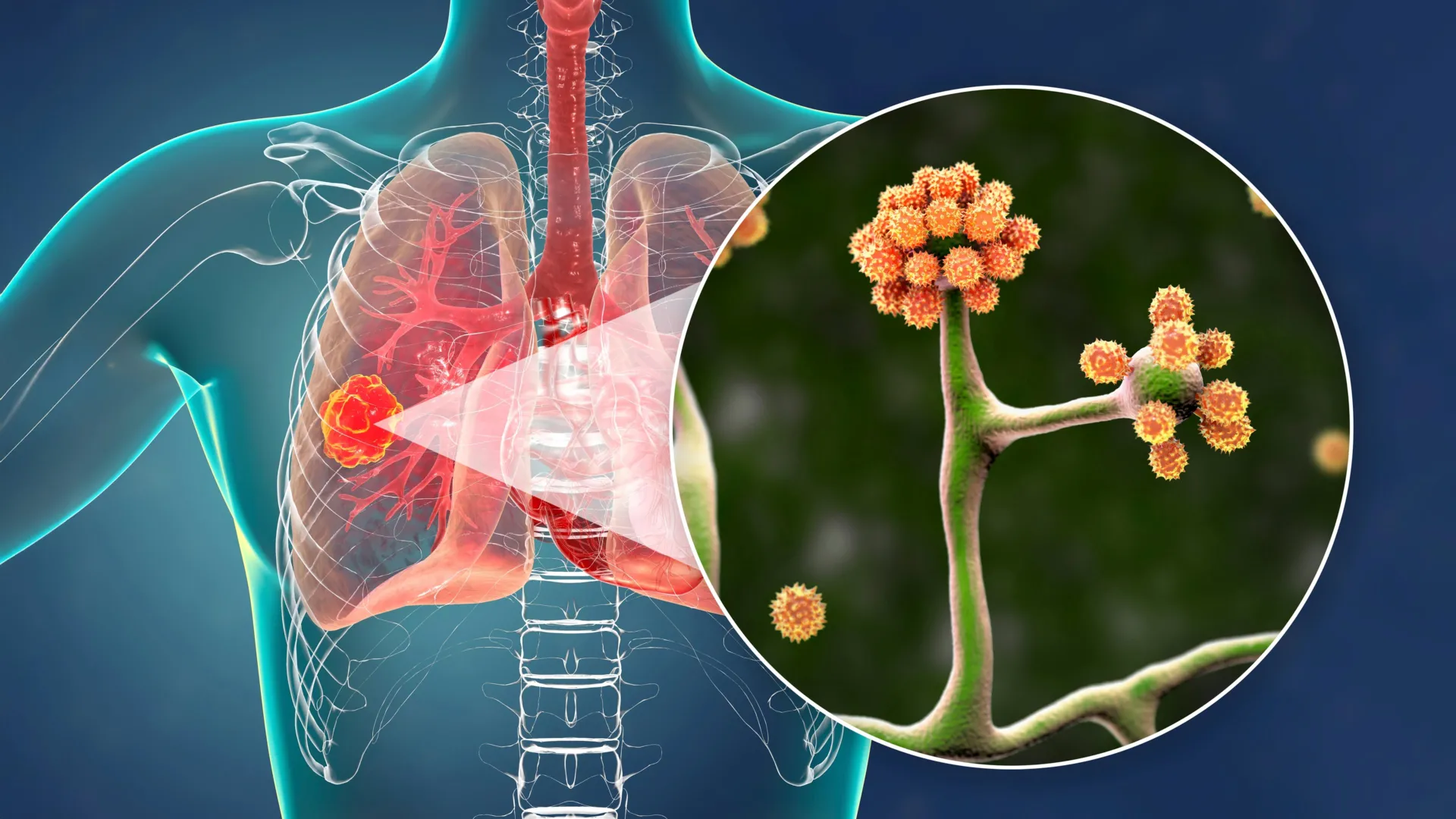 Esta proteína sanguínea simples pode impedir um fungo negro mortal