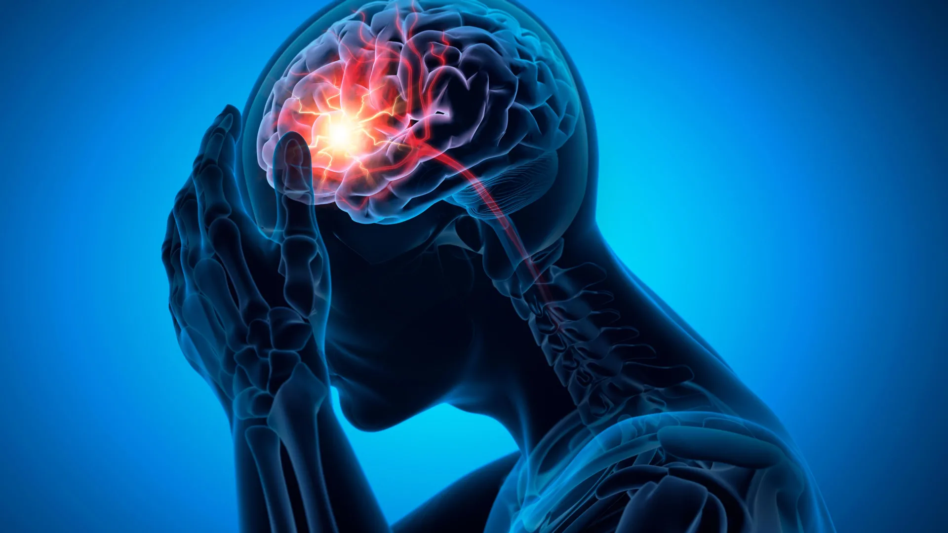 165.000 pacientes com demência revelam risco oculto de derrame causado por medicamento comum