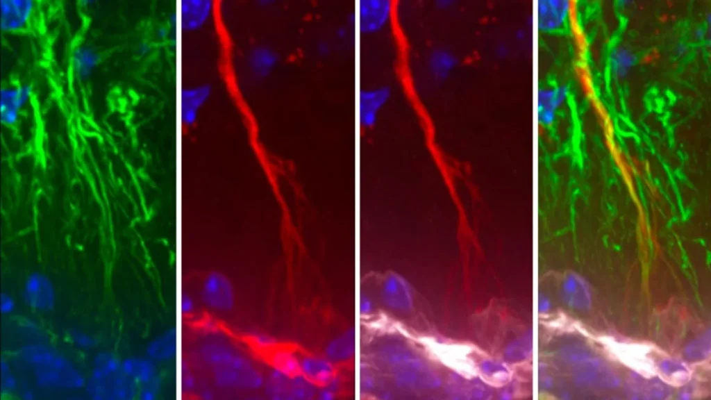 Cientistas descobrem células cerebrais ocultas que podem impedir a acumulação de tau na doença de Alzheimer.