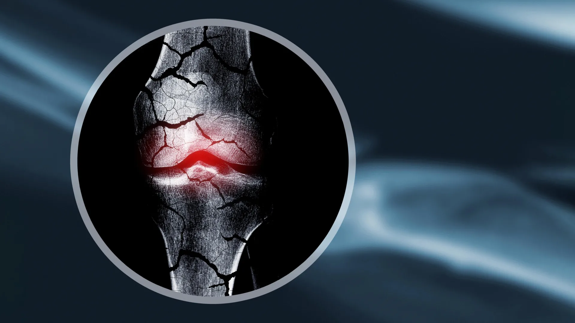 Cientistas criam scaffold de cartilagem que ajuda o corpo a regenerar os ossos