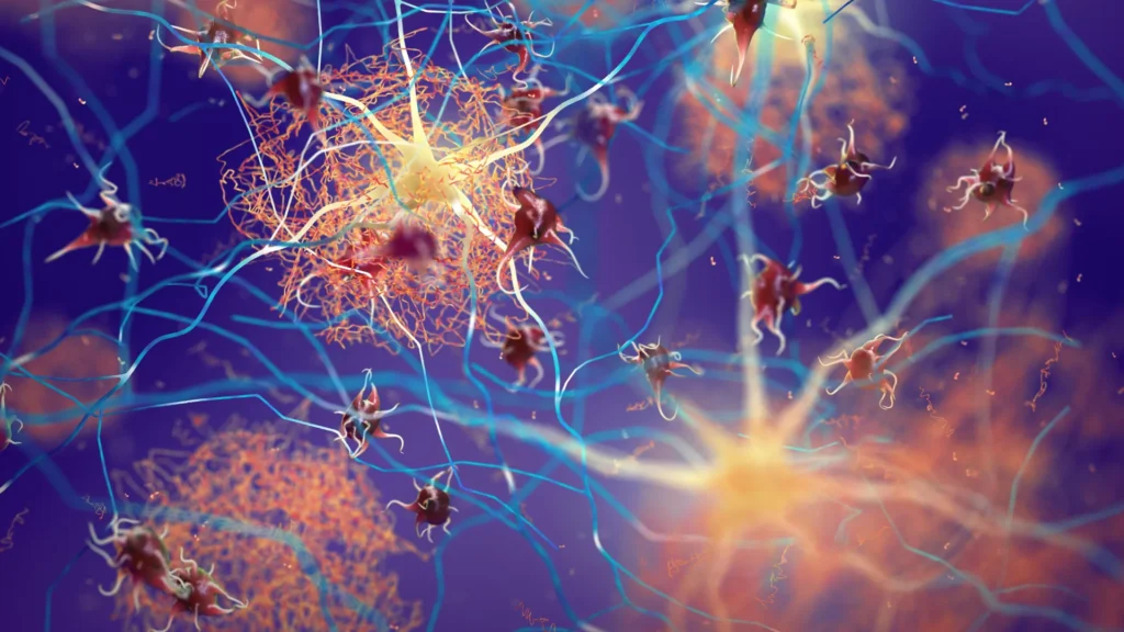Proteína impulsionadora ajuda o cérebro a combater o Alzheimer