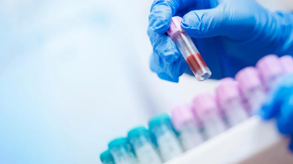 Um simples exame de sangue pode revelar o risco de Alzheimer anos antes