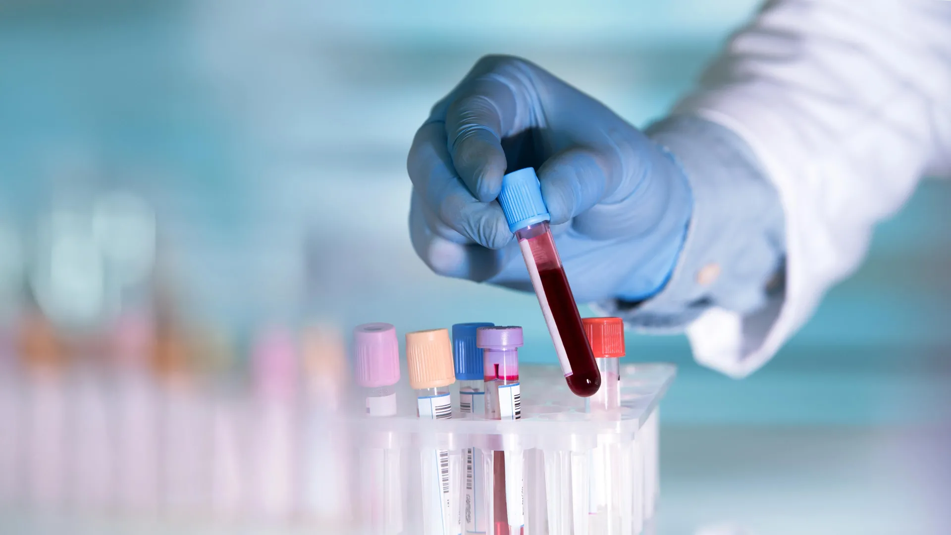 Este simples exame de sangue pode detectar a depressão antes dos sintomas aparecerem.