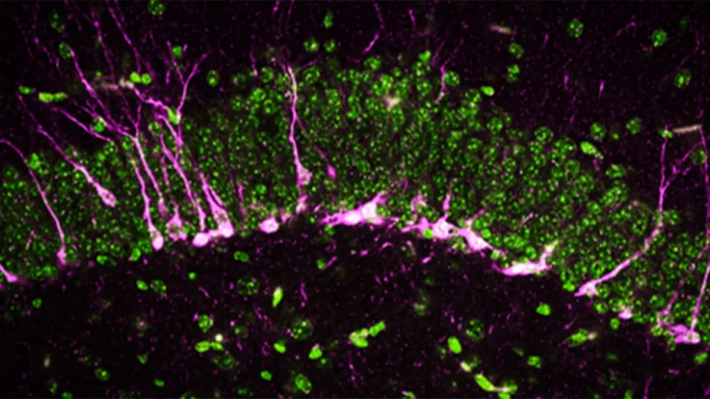 "Gás de ovo podre pode ser a chave para combater a doença de Alzheimer"
