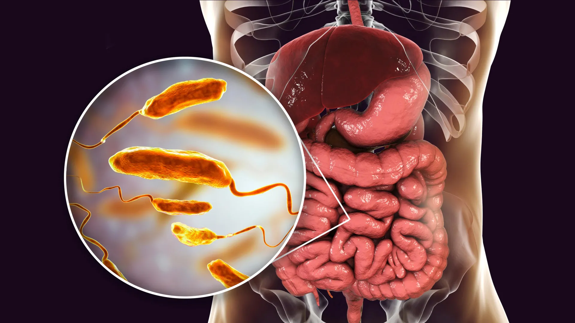 Esta dieta pode reduzir as infecções de cólera em até 100 vezes