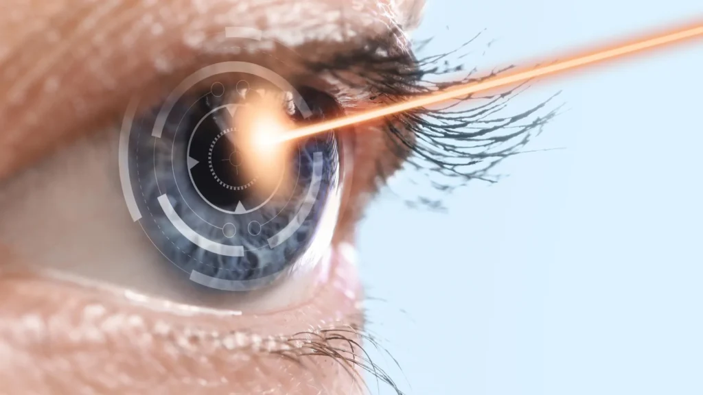 Novo tratamento a laser pode prevenir a cegueira antes que ela comece