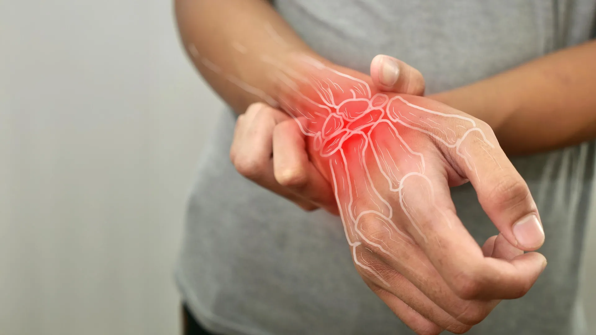 Este medicamento atrasou a artrite reumatoide por anos após o término do tratamento